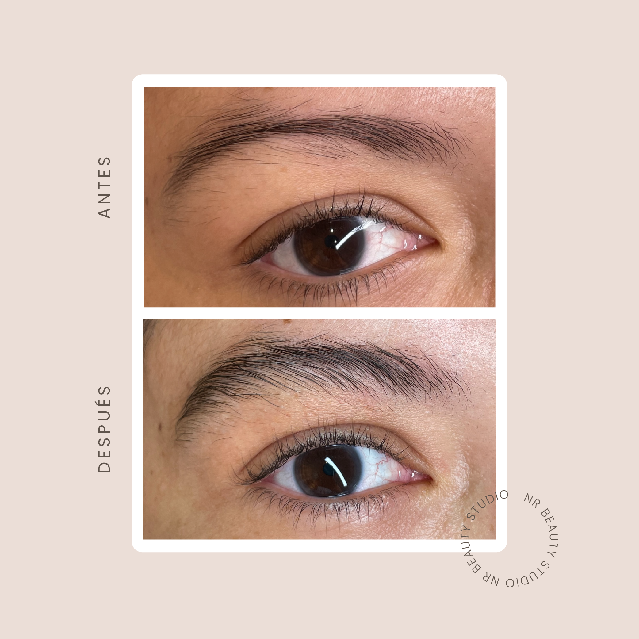SERÚM ESTIMULANTE DE CEJAS NR.