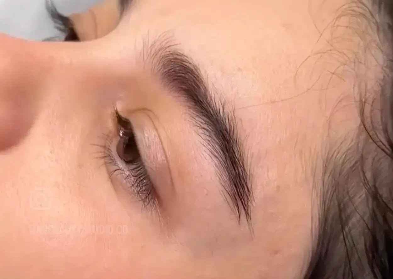 Alopecia areata: ¿Qué es y cómo tratarla desde el punto de vista de una experta en cejas?